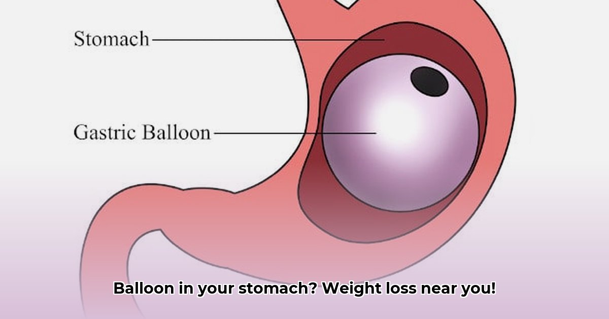 balloon-in-stomach-for-weight-loss-near-me